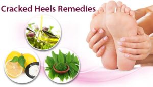 ஓரே வாரத்தில் குதிகால் வெடிப்பை மறைய செய்ய வேண்டுமா? இதோ சூப்பர் வீட்டு வைத்தியம்..!