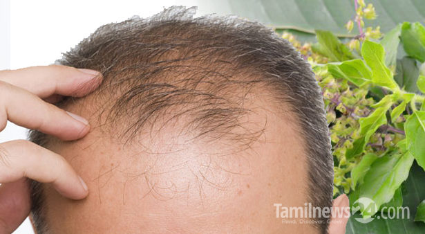 சொட்டை விழுந்த இடத்தில் முடியின் வளர்ச்சியைத் தூண்ட உதவும் சில ஆயுர்வேத வழிகள்!