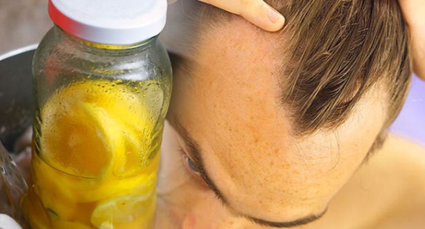 முடி உதிர்ந்த இடத்தில் முடி அடர்த்தியாக வளர 10 நாட்கள் போதும்… இத பண்ணுங்க…!!