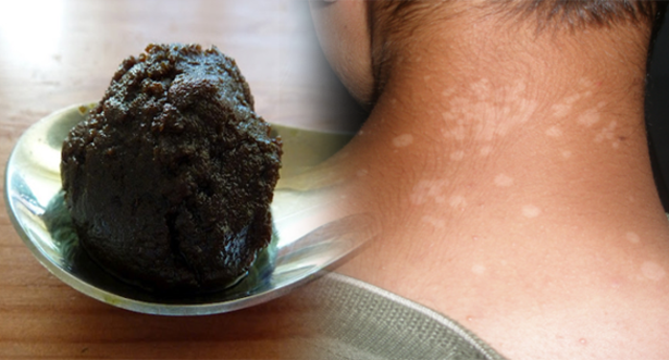 சளித் தொல்லையில் அவதிப்படுபவர்களா நீங்கள்? இதோ நிவாரணம்..!