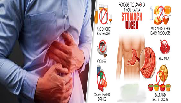 அல்சர் ஆபத்திலிருந்து தப்பிக்க… சாப்பிட வேண்டியவை… தவிர்க்க வேண்டியவை..!