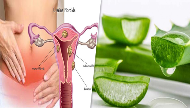 கருப்பையில் உள்ள பிரச்சனைகளுக்கு உடனடித் தீர்வு தரும் கற்றாழை இப்படி சாப்பிடுங்க..!