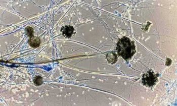 தமிழகத்தில் அதிகரித்து வரும் கருப்பு பூஞ்சை -10 பேருக்கு கண்கள் அகற்றப்பட்டுள்ளன.