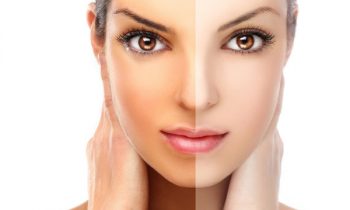 முகம்- கருமை நீங்க..!!