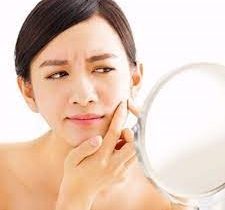 பருக்கள் நீங்க…!!