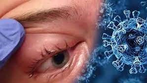 இலங்கையில்   கரும்பூஞ்சை நோயால்  முதலாவது மரணம் சம்பவித்துள்ளது.