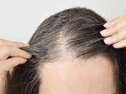 வெள்ளை முடியை கருமையாக மாற்ற..!!