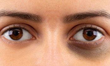 கண்களில் கருவளையம் நீங்க..!!!