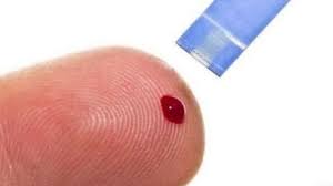 கொவிட் தொற்றால் பாதிக்கப்பட்டவருக்கு நீரழிவு நோய் ஏற்படுமா?