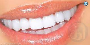 பளிச் பற்களை பாதுகாப்பது எப்படி?