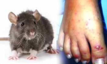 எலி காய்ச்சலால் பாதிக்கப்படுபவர்களின் எண்ணிக்கை அதிகரிப்பு.