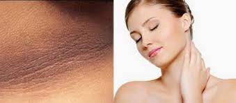 கழுத்து கருமை நீங்க..!!