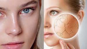 முகத்தில் உள்ள எண்ணெய் பசை நீங்க டிப்ஸ்..!!