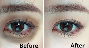 கருவளையம் நீங்க டிப்ஸ்….!!