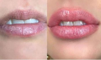 உதடு சிவப்பாக டிப்ஸ்.!!