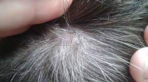 நரை முடி கருப்பாக மாற எண்ணெய்…!!