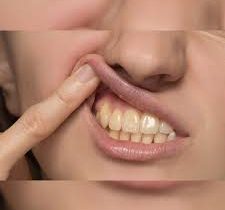 மஞ்சள் பல் வெள்ளையாக என்ன செய்ய வேண்டும்?